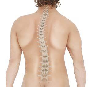 Scoliosis