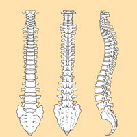 Anterior Lumbar Interbody Fusion