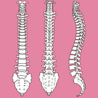 Lumbar Spine Stenosis