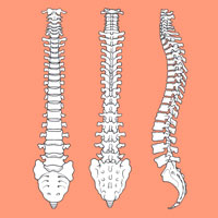 Transforaminal Lumbar